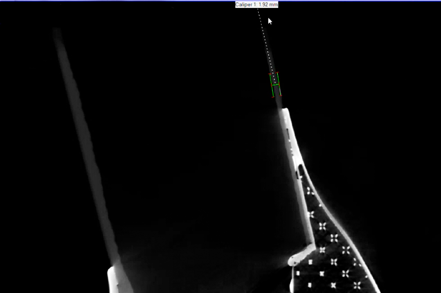 CT scan screenshot