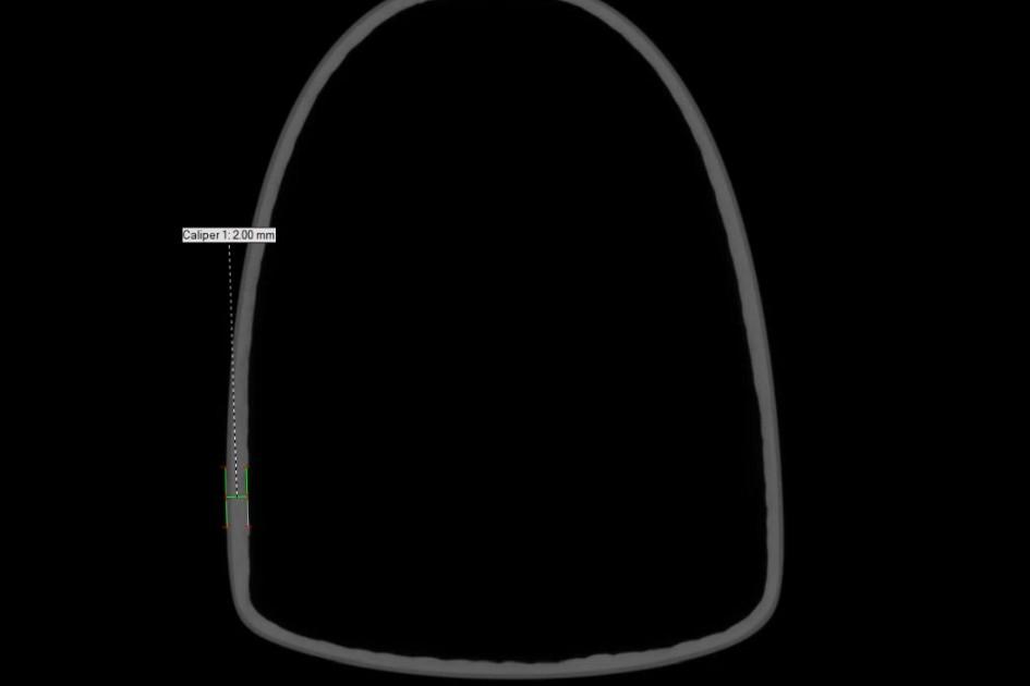 CT grayscale scan shows a Bastion bike component