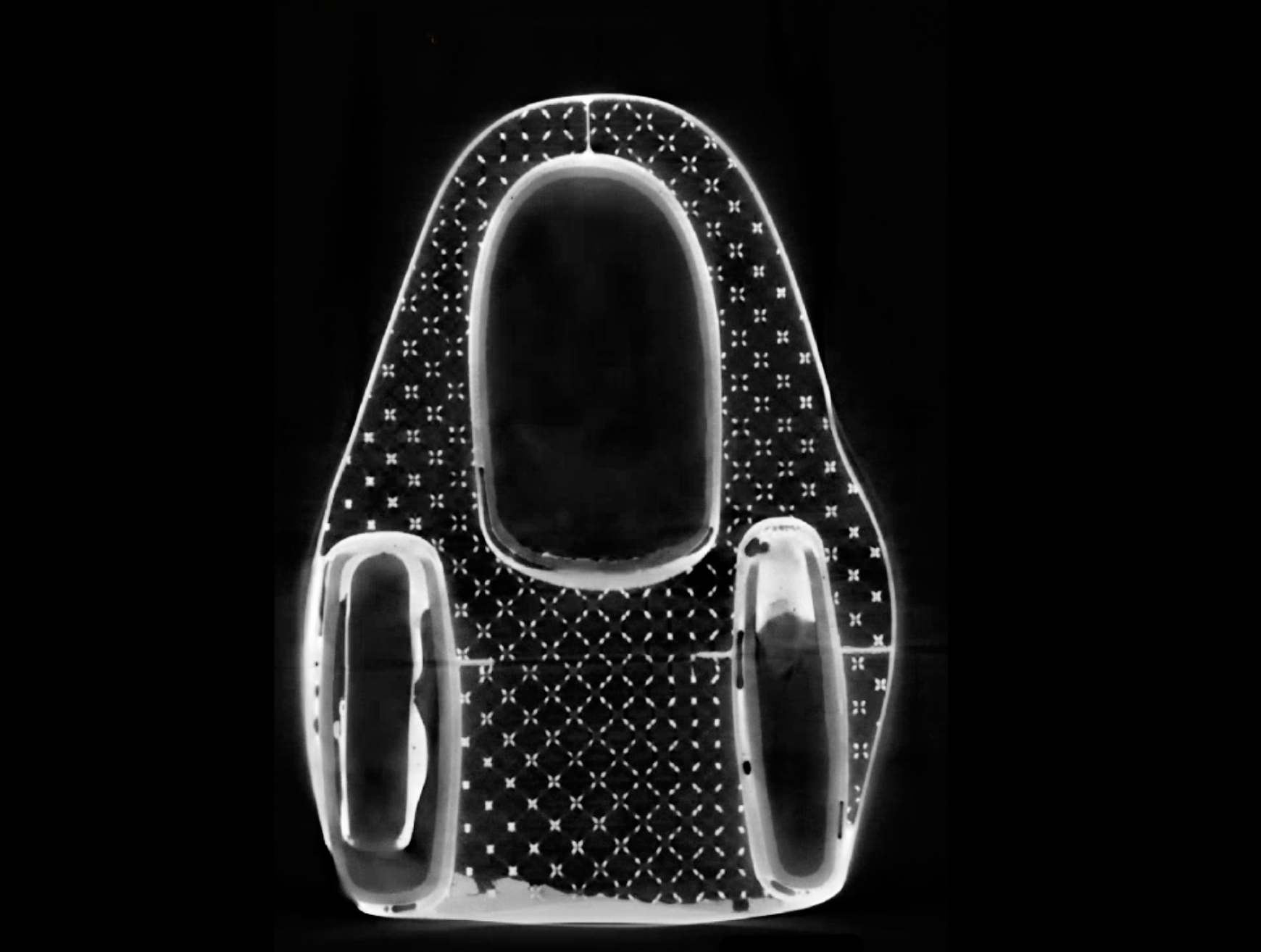 CT scan of Bastion latticework