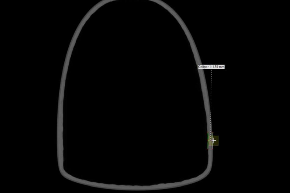 CT grayscale scan shows a Bastion bike component