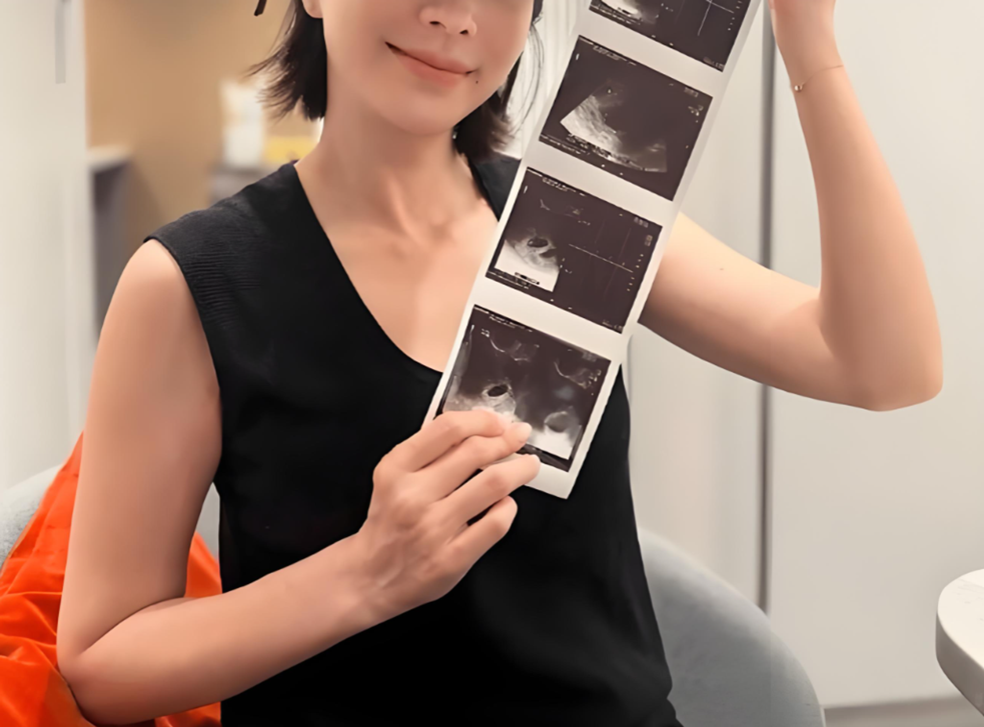 大龄女性冻卵