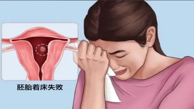 试管婴儿移植失败