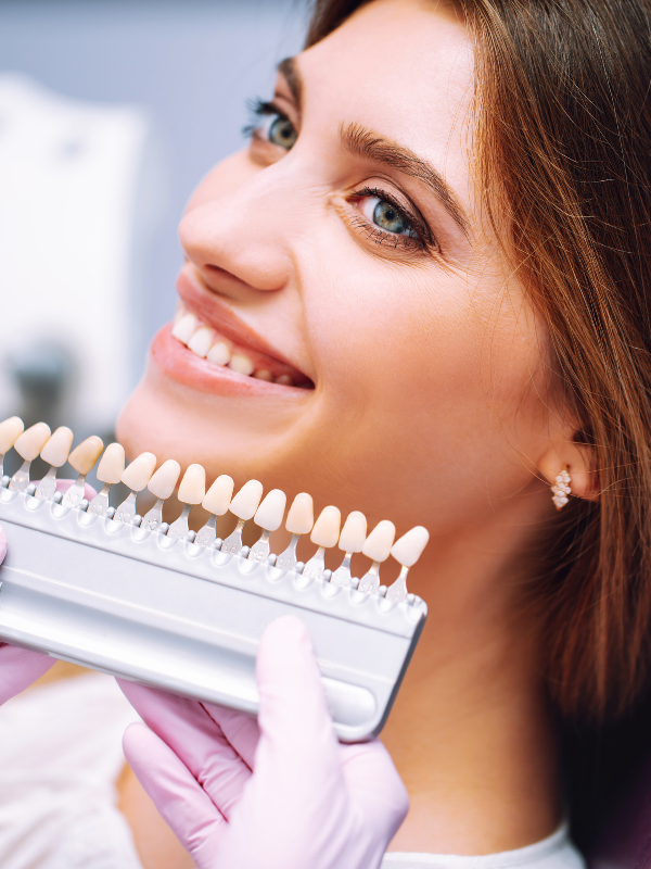 Call the Experts for Smile Makeover Consultation