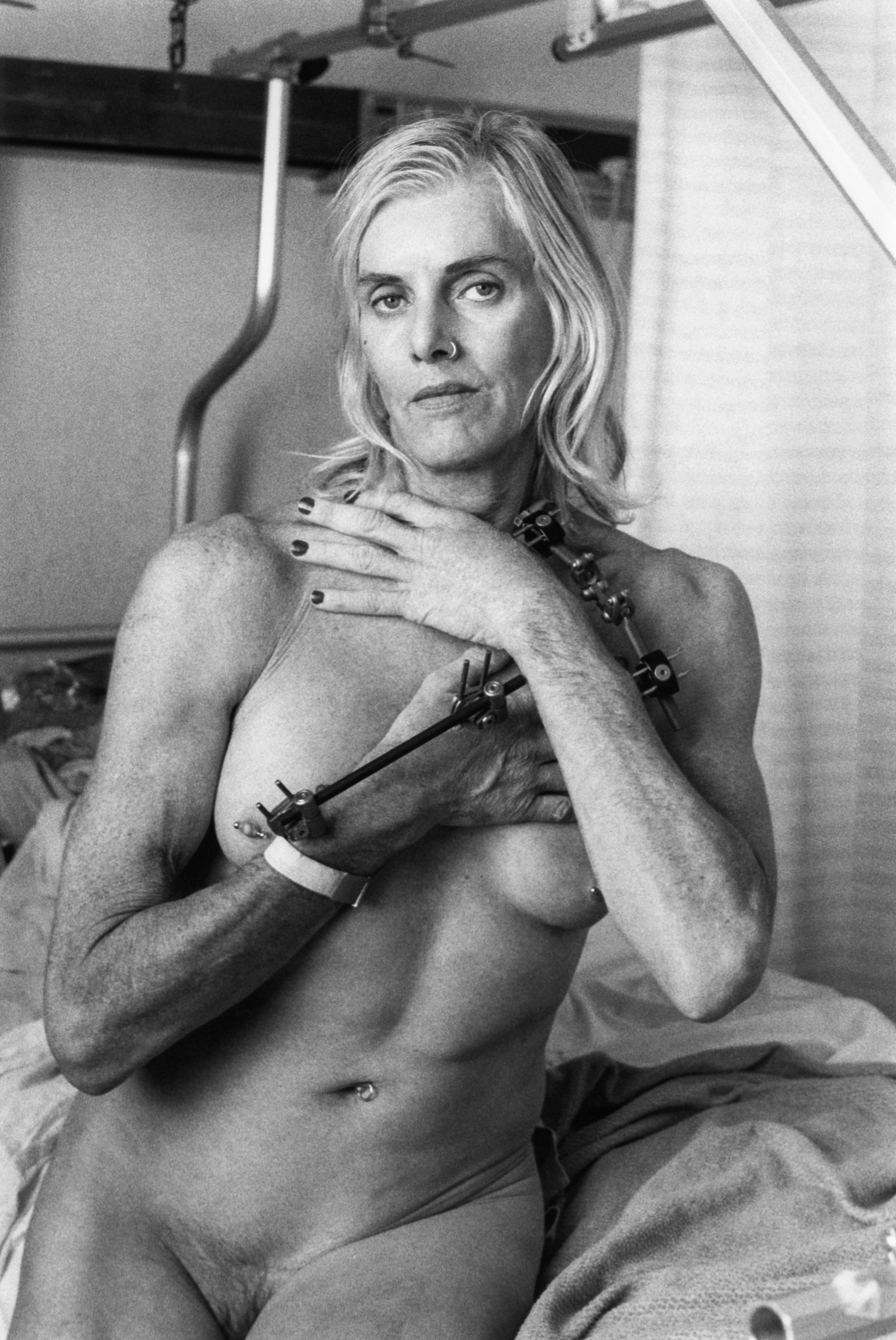 Black and white self-portrait of the artist Pippa Garner, pictured nude with a mechanical arm brace, circa 1997