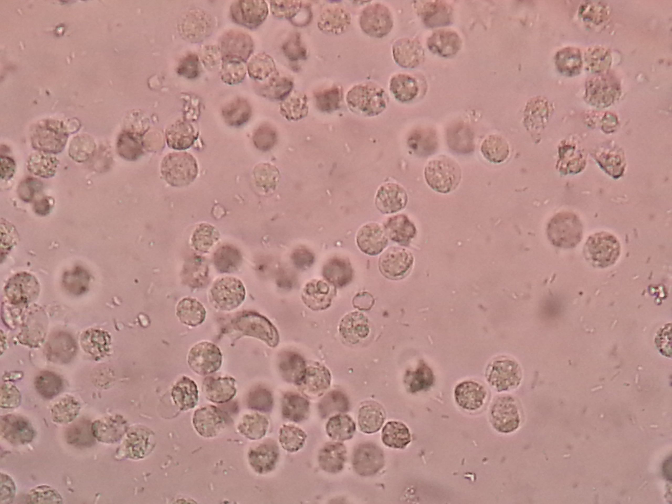 Why UTIs in Elderly Often Go Unnoticed: Warning Signs You Can't Miss