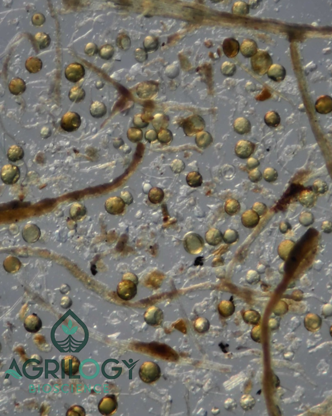 VAM Technical-33,000 Spores Per Gram thumbnail 4