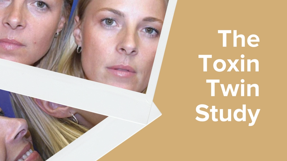 Twins Study Reveals the Power of Botox for Youthful Skin Glowday