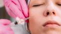 banner for The Midface Sag: Cheek Fillers for Facial Rejuvenation