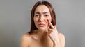 banner for What Helps Rosacea? The Dos and Don'ts