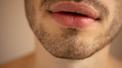 banner for The Rise and Rise of Lip Fillers for Men