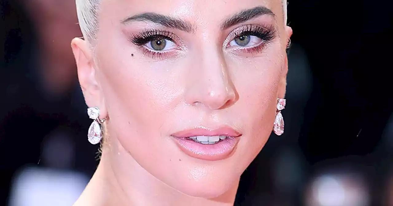 Botox of Fillers? What's Lady Gaga Had Done? Glowday