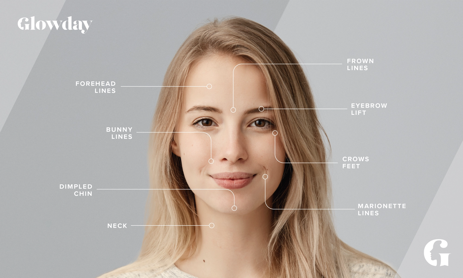 Botox areas