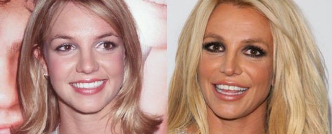 Britney Spears at 40 Botox of Fillers Glowday
