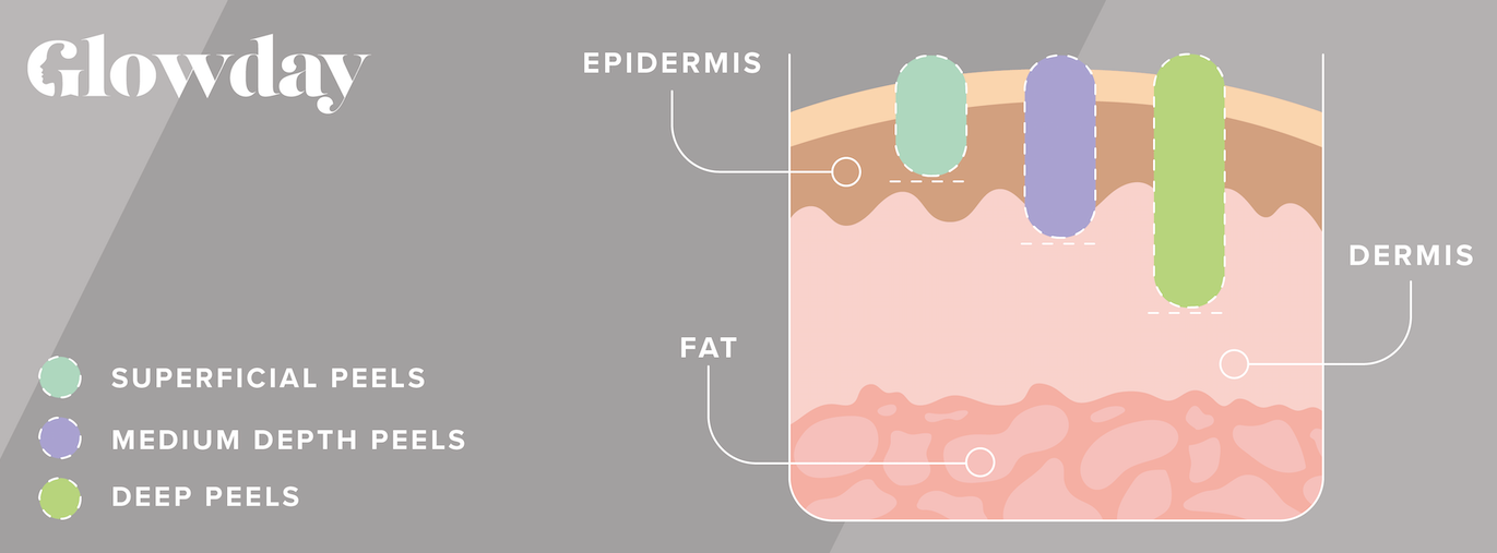 Chemical peels At home or in a clinic Glowday photo