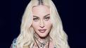 banner for Filters or Botox? How Does Madonna Look Like This At 63! 