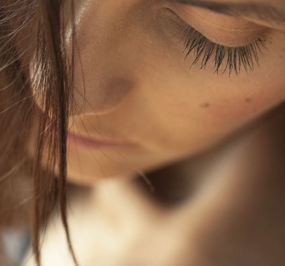 Chemical Peels For Acne And Acne Scars Glowday