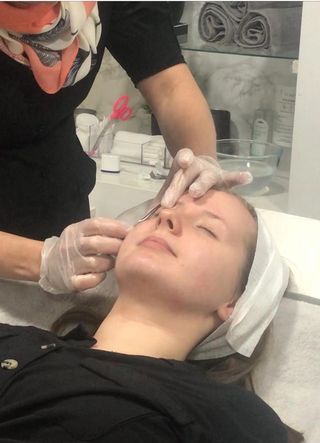 During dermaplaning