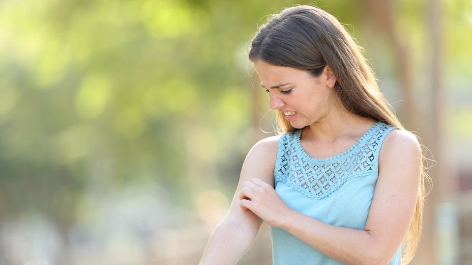 What Is The Best Over The Counter Cream For Eczema? Explained Simply