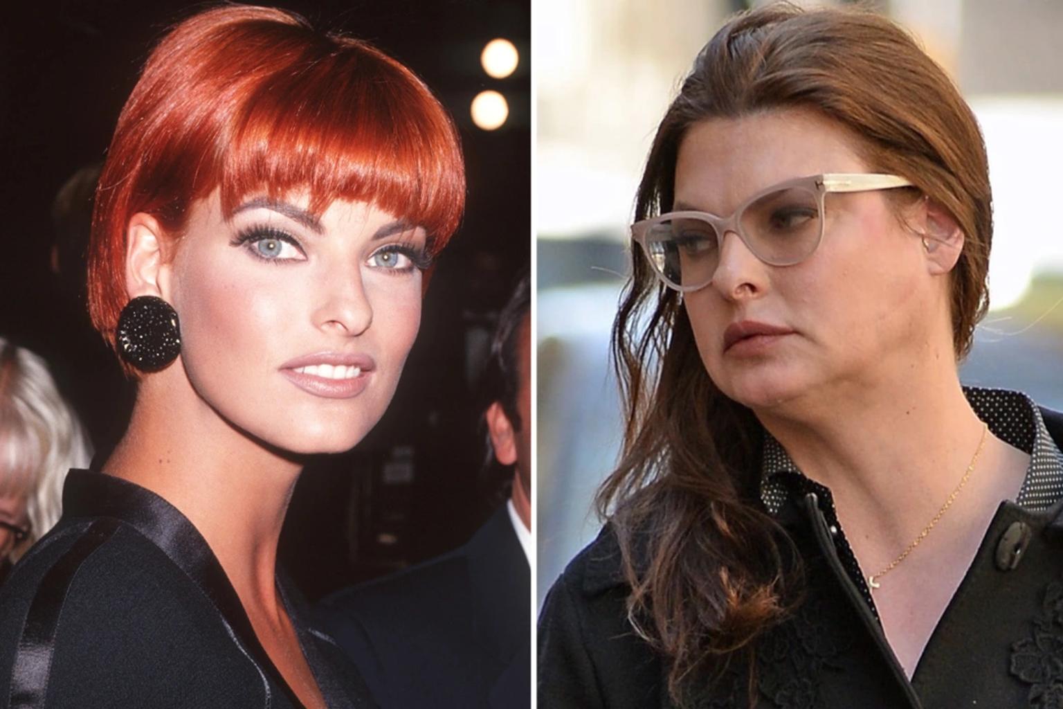Should I Avoid CoolSculpting After Linda Evangelista's Reaction? Glowday
