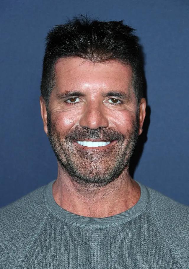 Simon Cowell full of filler back in 2019 - Photo credit: WireImage