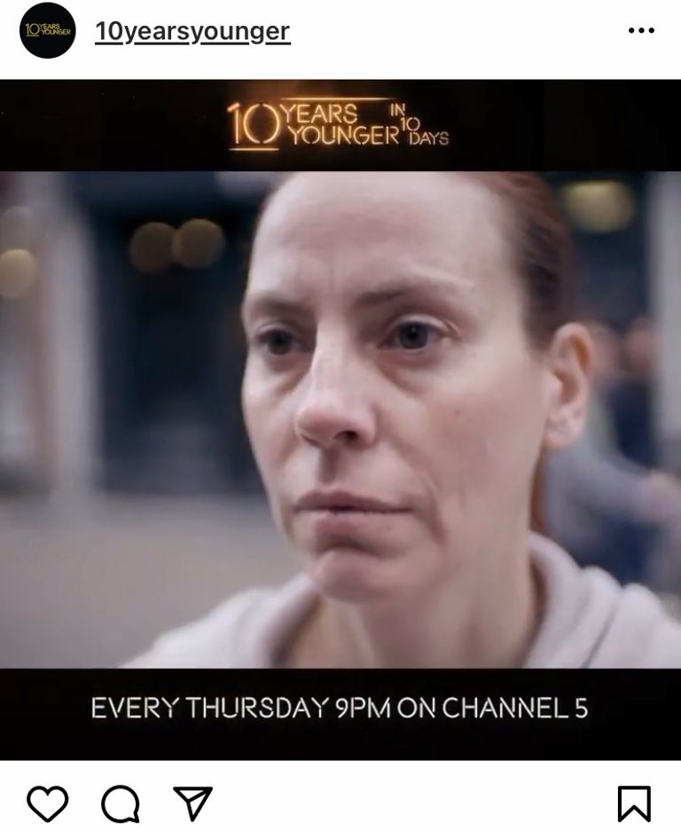 10 Years Younger Is More Achievable Than Ever | Glowday