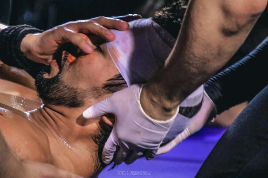 Keyton siendo vendado luego de un corte en su cabeza