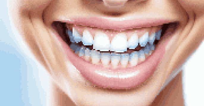 A close-up of a person smiling, displaying clean teeth and healthy gums, with soft lighting and a blue background.
