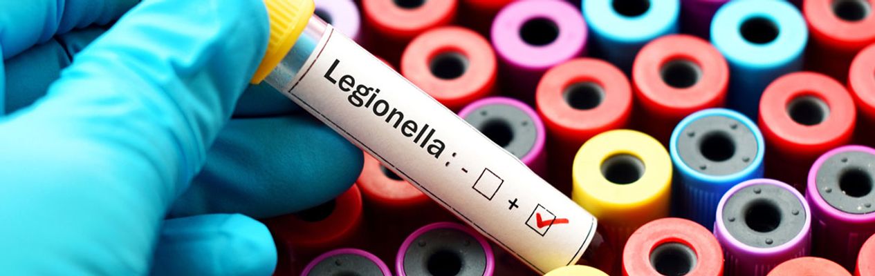 Artikel header afbeelding