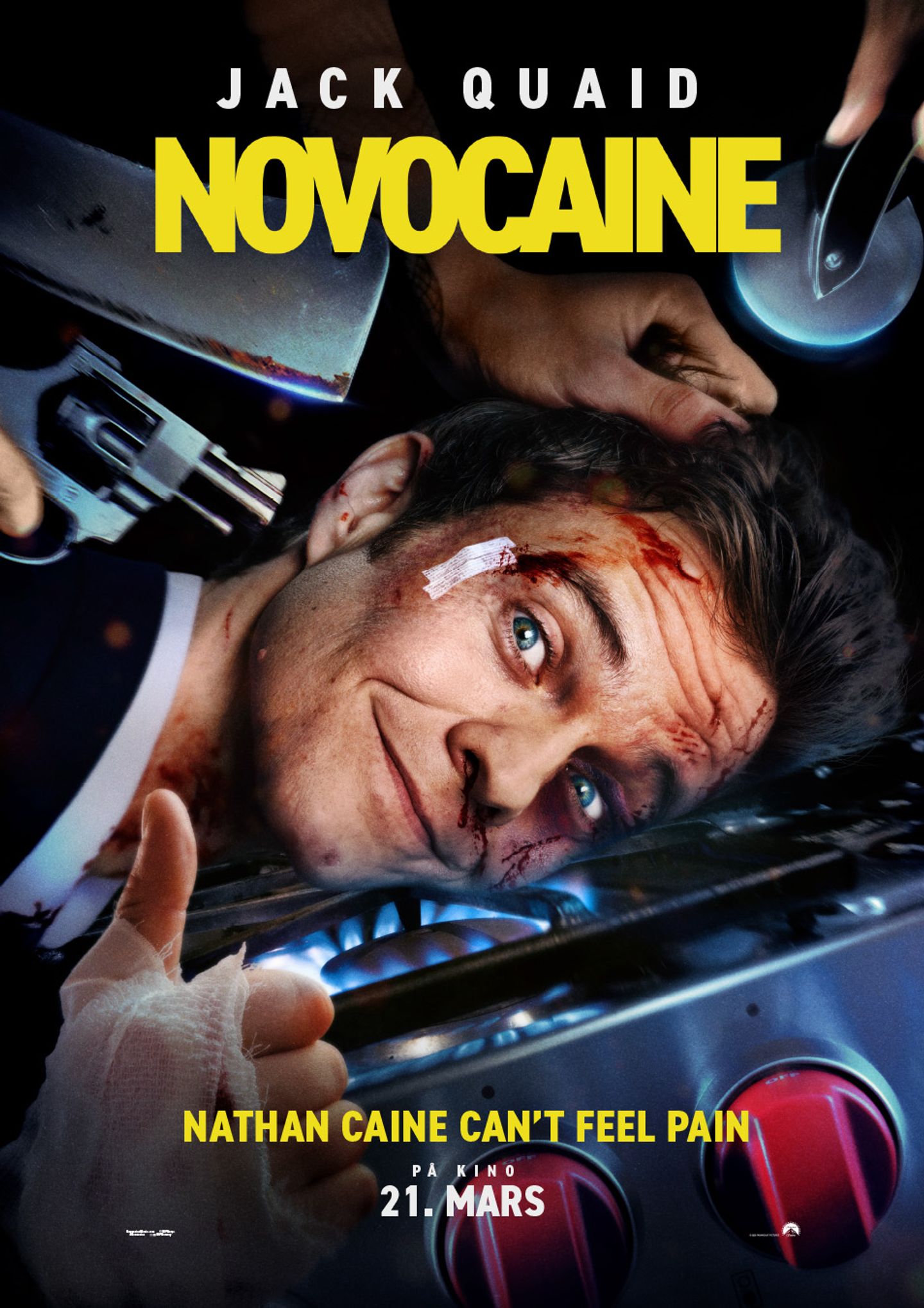 Novocaine