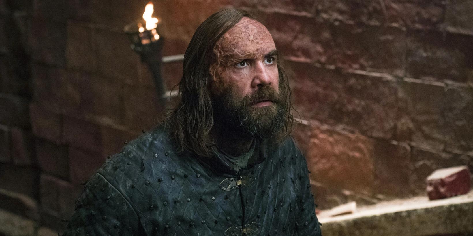 Rory McCann som The Hound i Game of Thrones