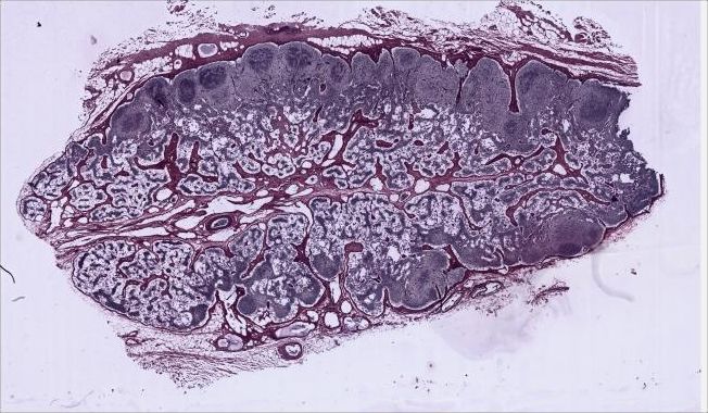 Full original silver-stained lymph node section 22 from Columbia University