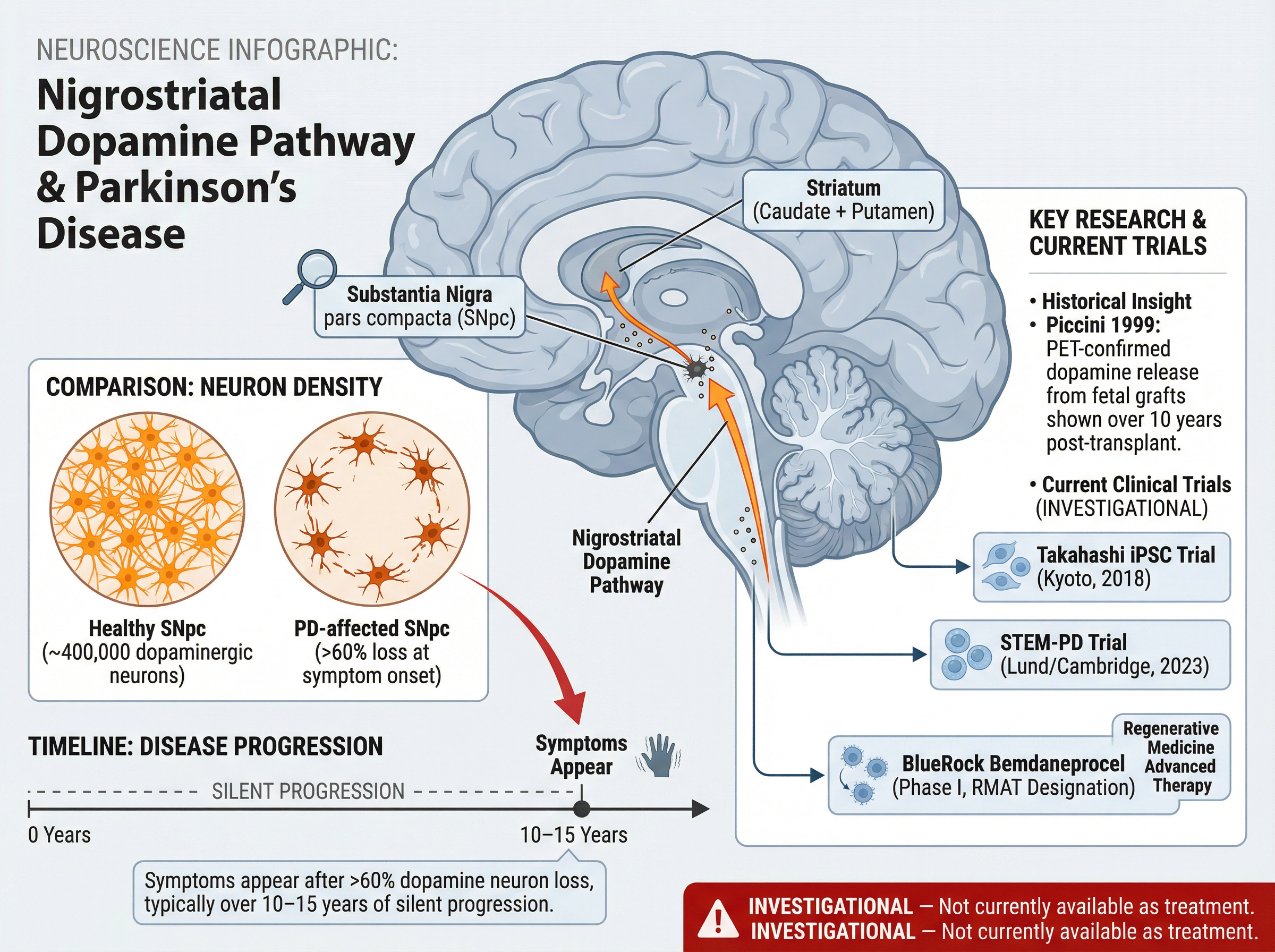 Diagram showing the substantia nigra and dopamine pathway from midbrain to striatum