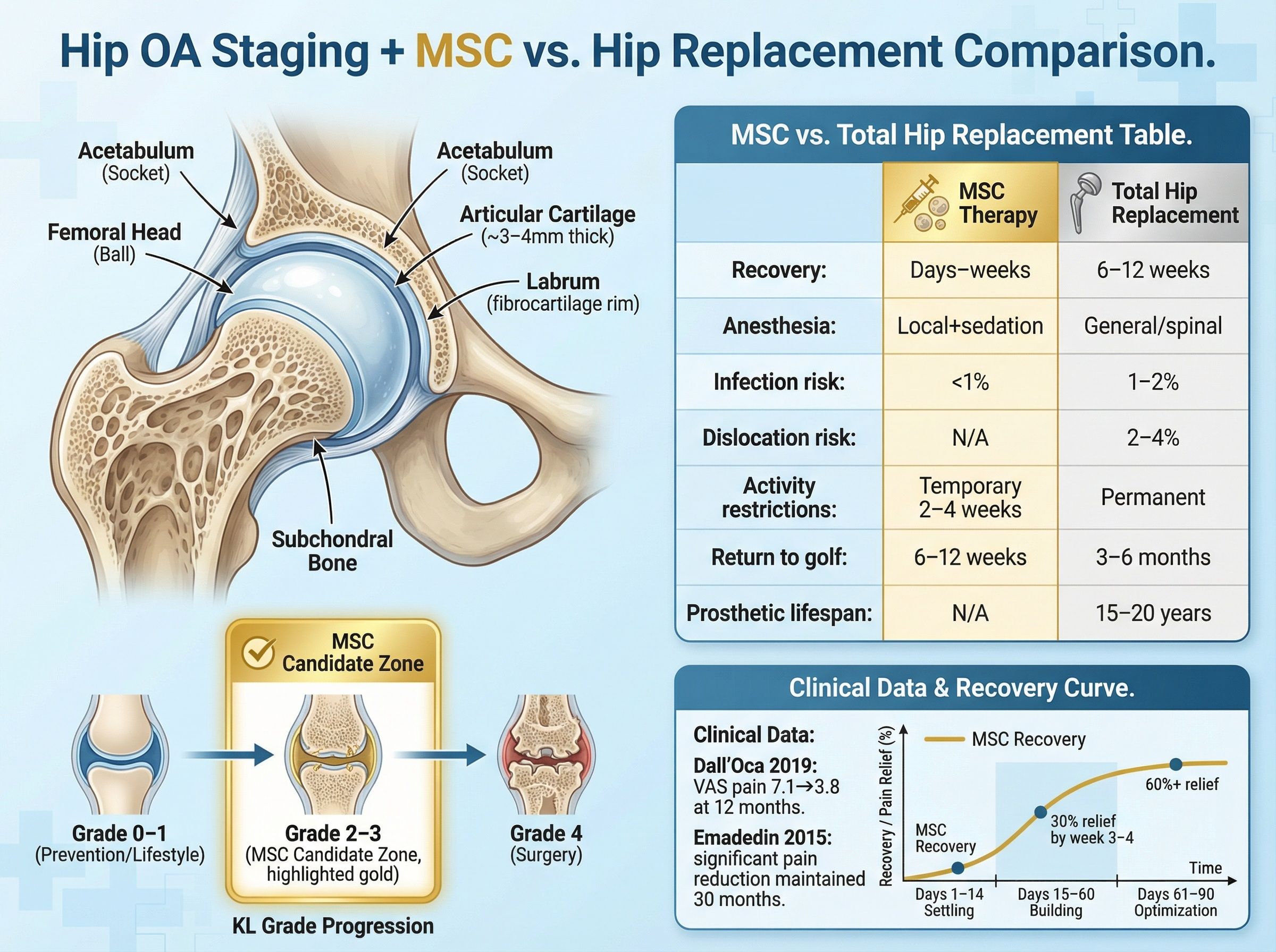 Cross-section anatomy of the hip joint showing cartilage