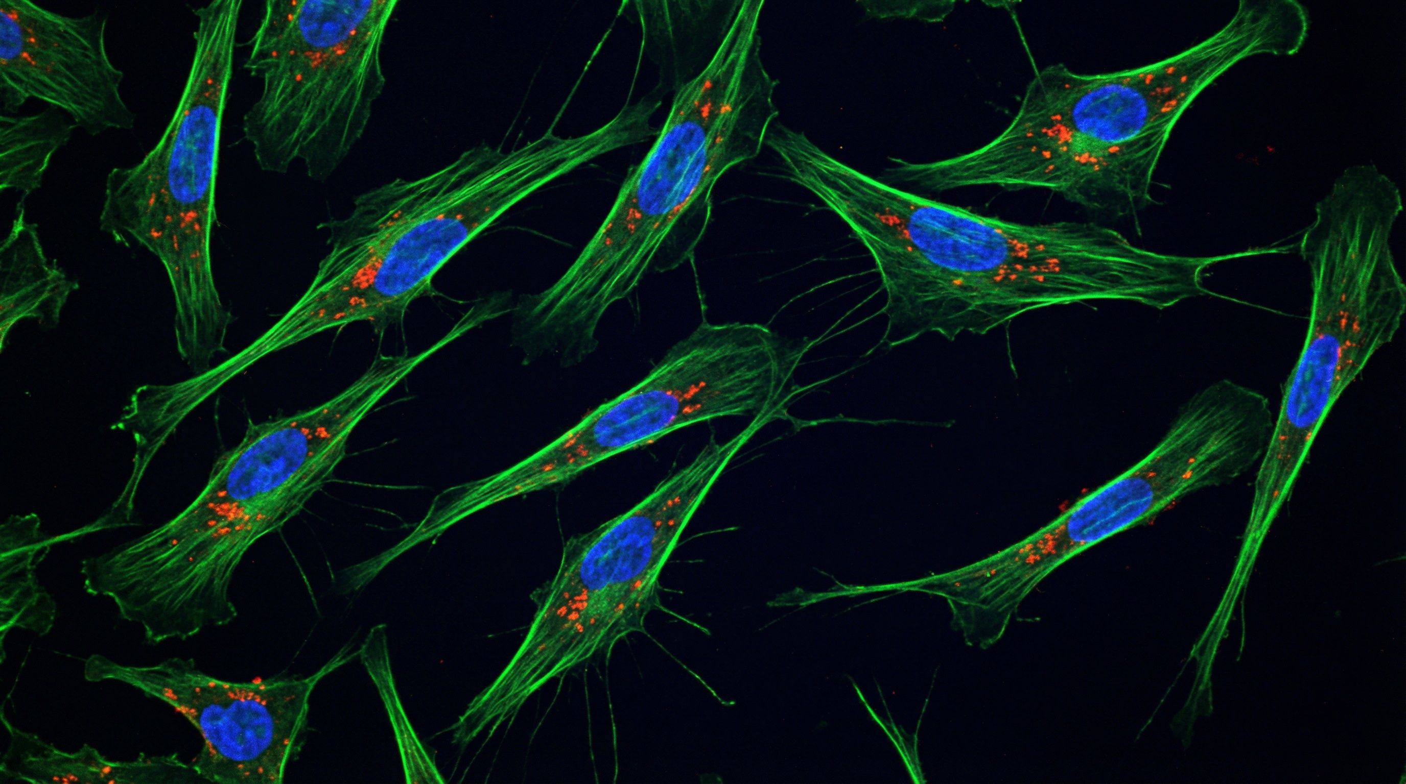 Fluorescence microscopy image of mesenchymal stem cells