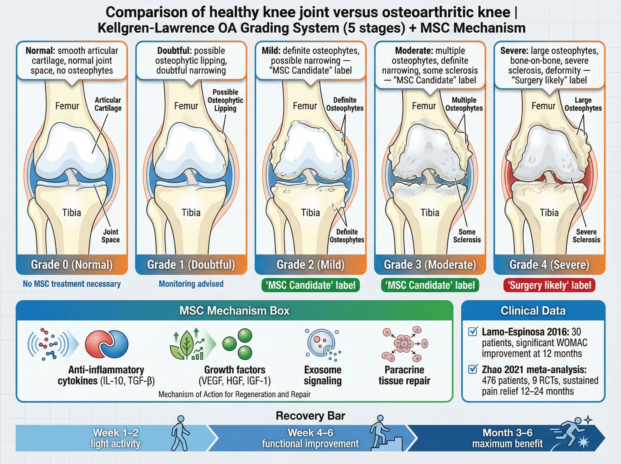 Comparison of healthy knee joint versus osteoarthritic knee