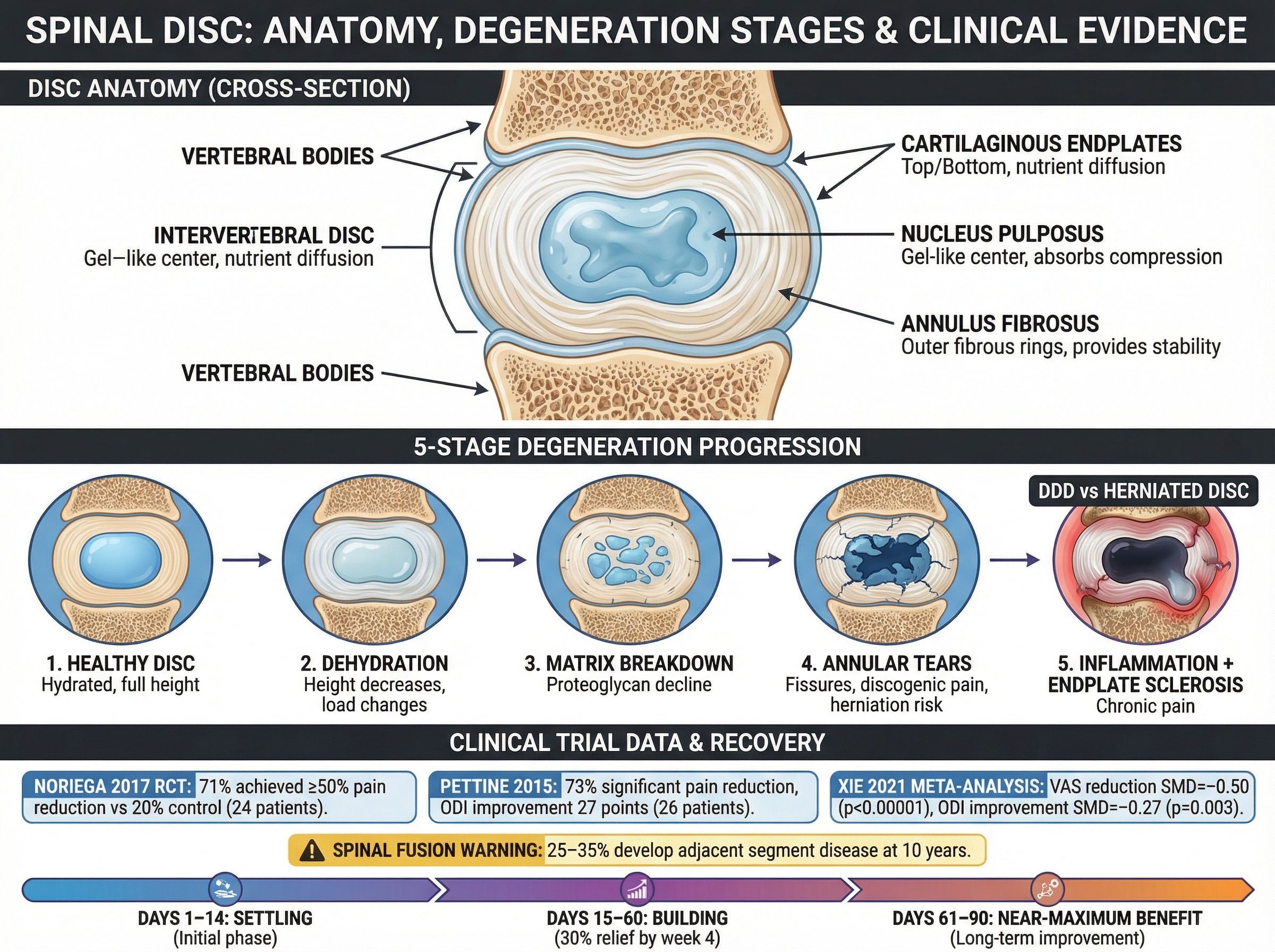 Cross-section of spinal disc showing degeneration stages