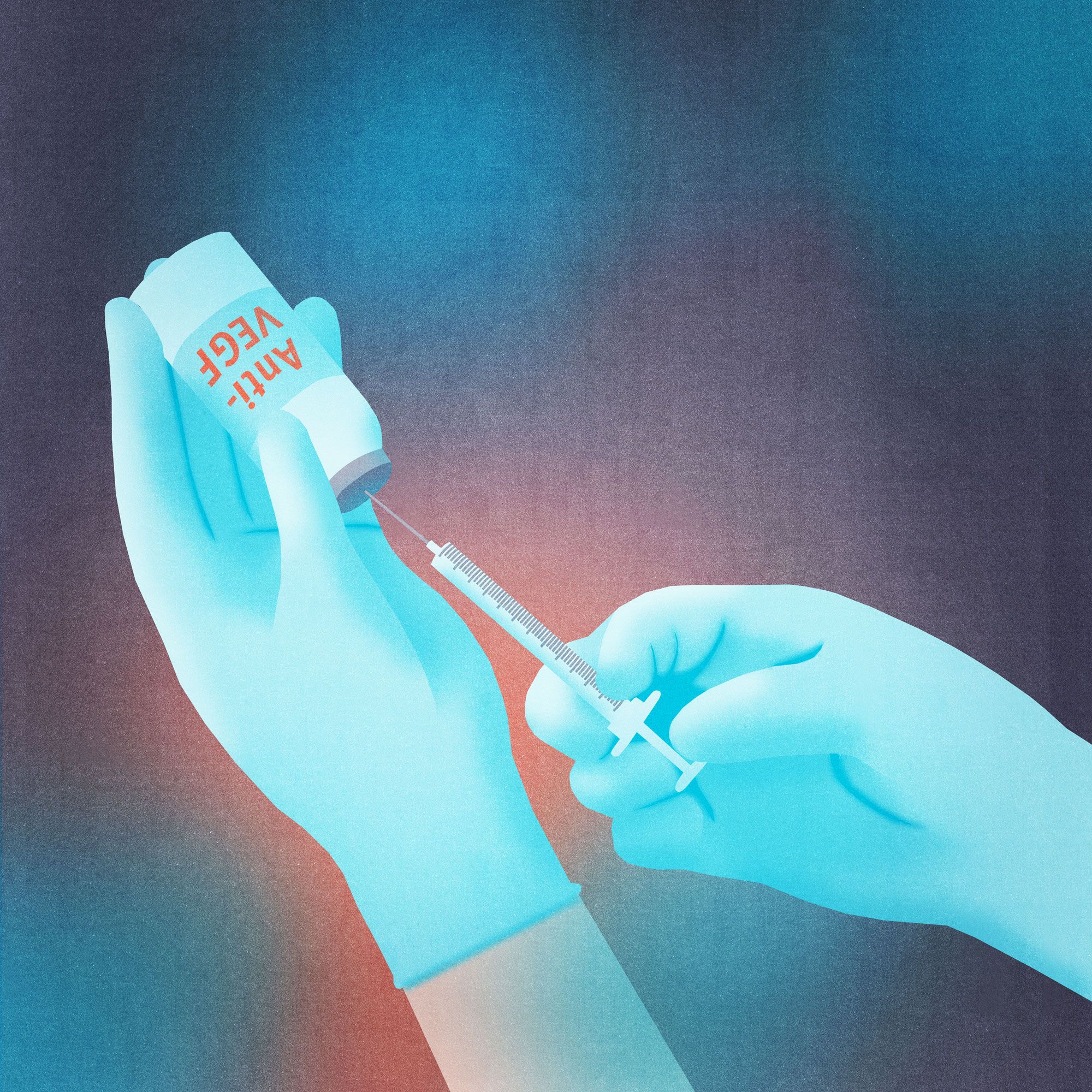 Symbolbild Intravitreale Injektionen