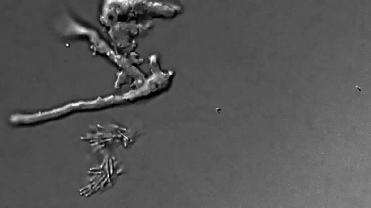 Greyscale phase-contrast micrograph of the amoeba Incendiamoeba cascadensis: elongated cells extending branched pseudopodia across a plain grey field, from NASA-funded research at Lassen Volcanic National Park