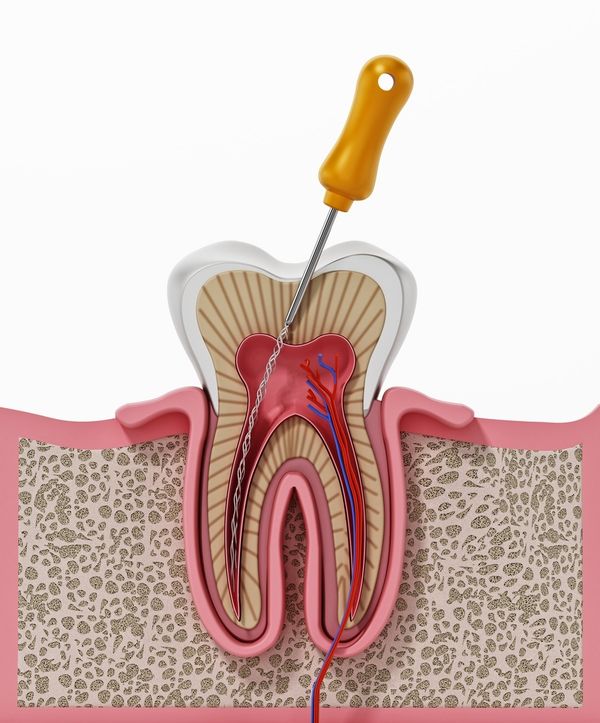Endodontie