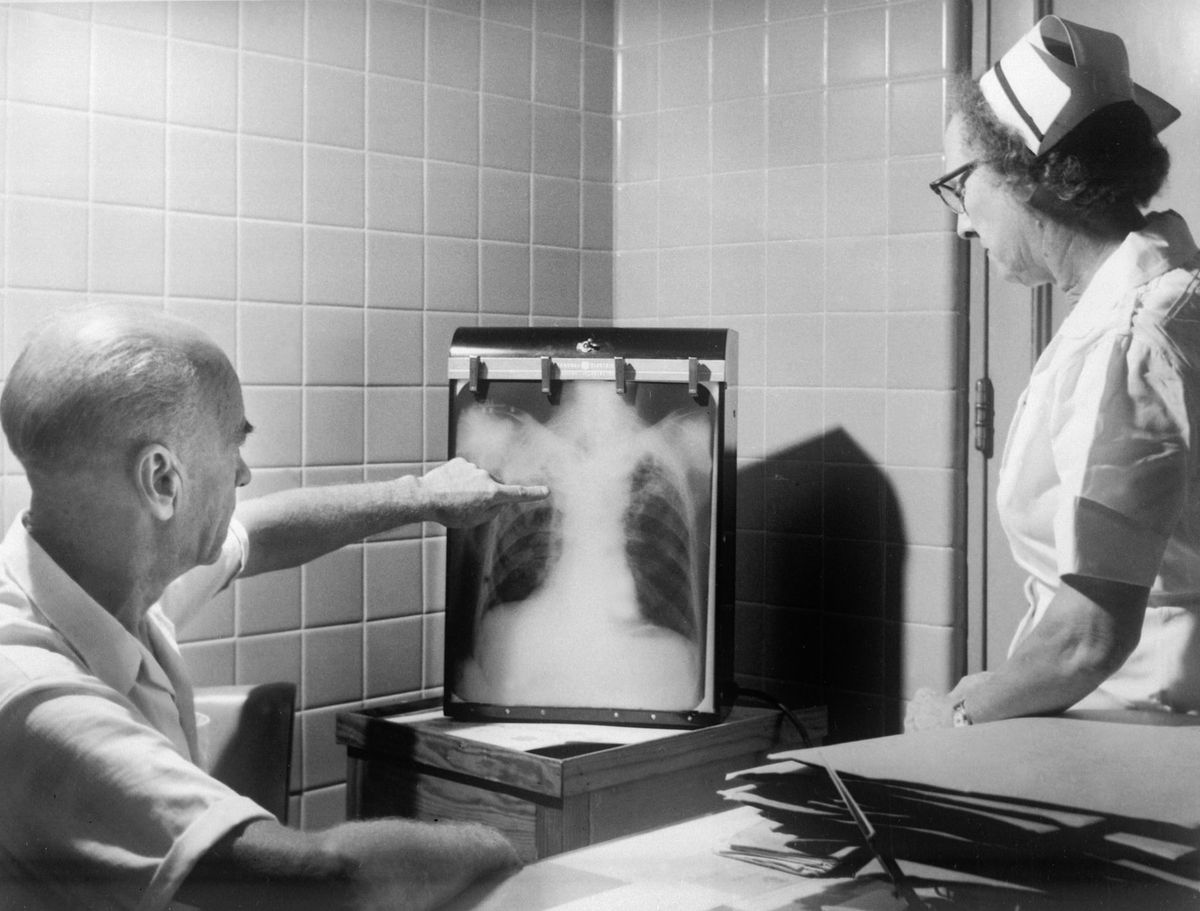 Presente e futuro da Tuberculose