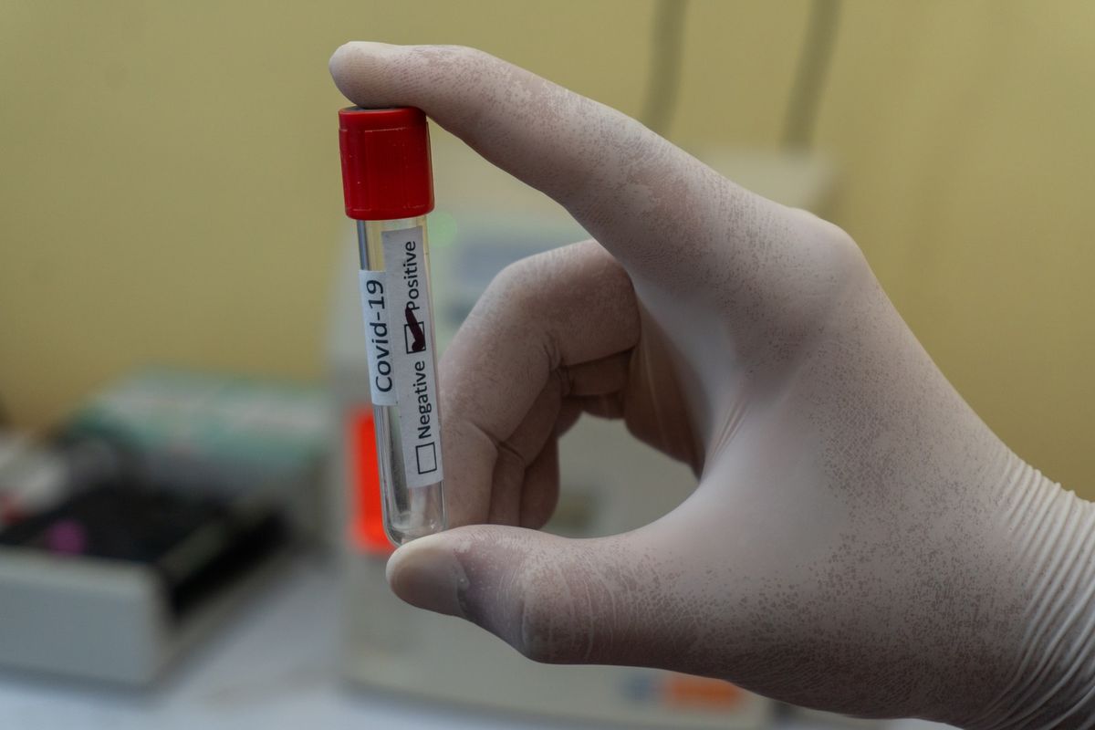 Aumenta o número de municípios brasileiros infectados pela variante Delta