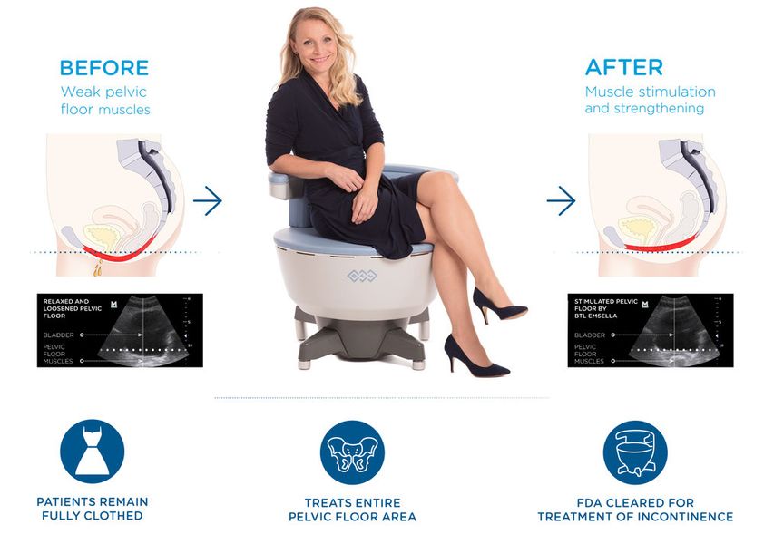 Emsella infographic with woman sitting on Emsella chair