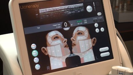 Ultherapy imaging device