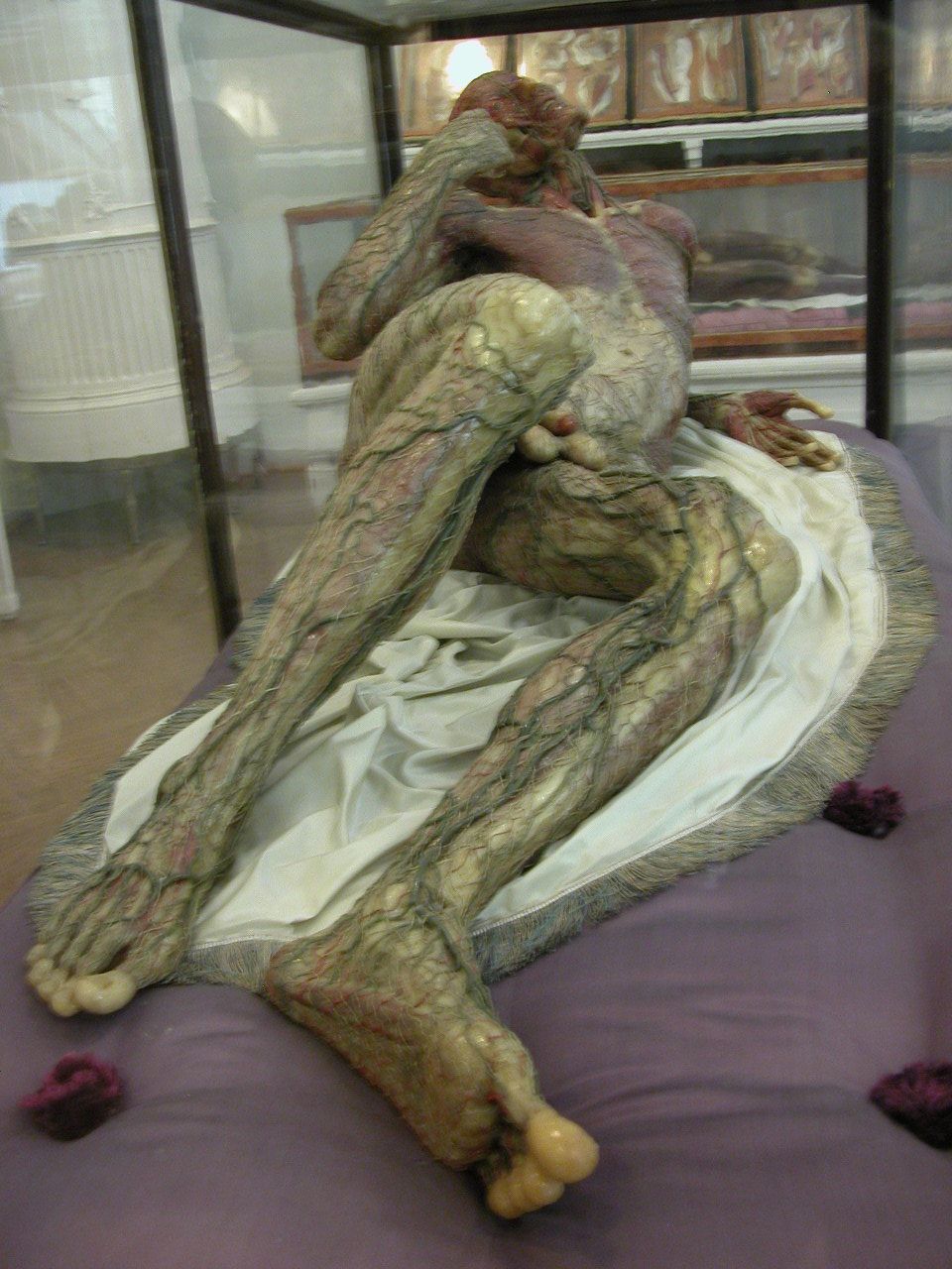 A reclining male anatomical wax figure with exposed muscles, supported on pale drapery in a glass case.