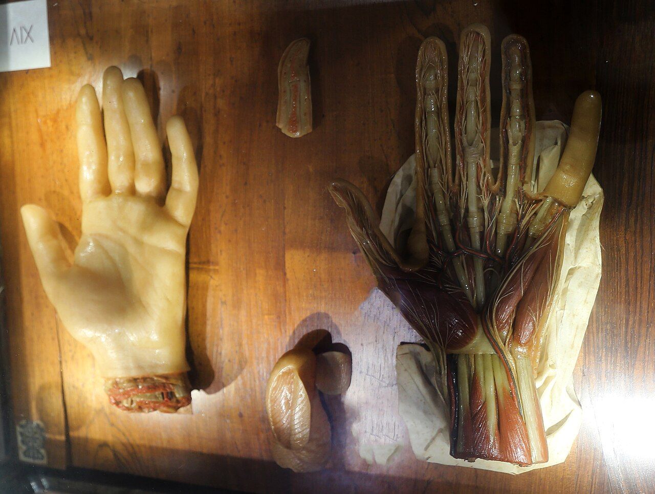 Two wax left hands, one intact and one with exposed nerves and muscles, beside enlarged finger and thumb models.