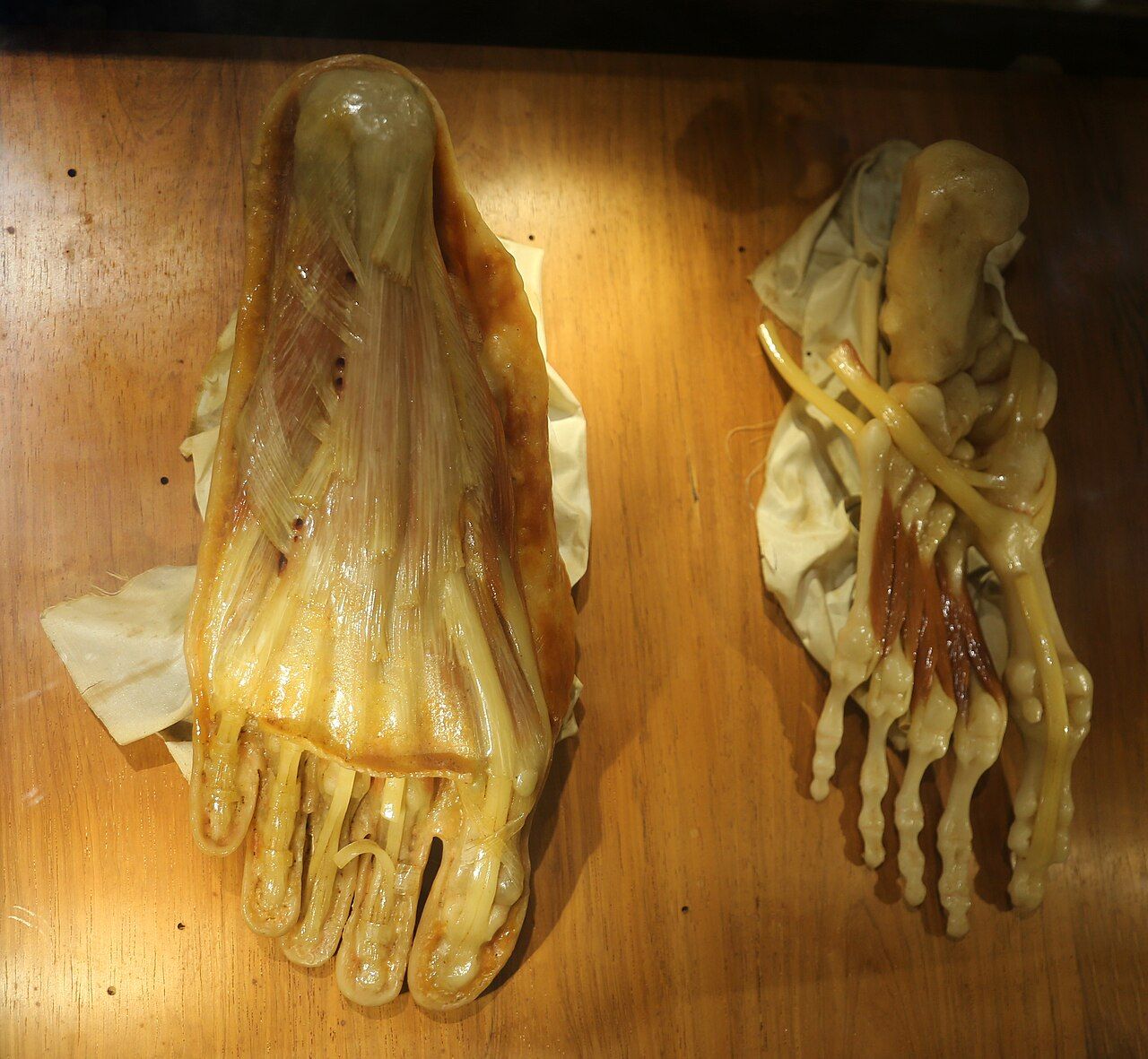 Two wax feet viewed from their soles, one with a pale covering sheet and one dissected to expose tendons and muscles.
