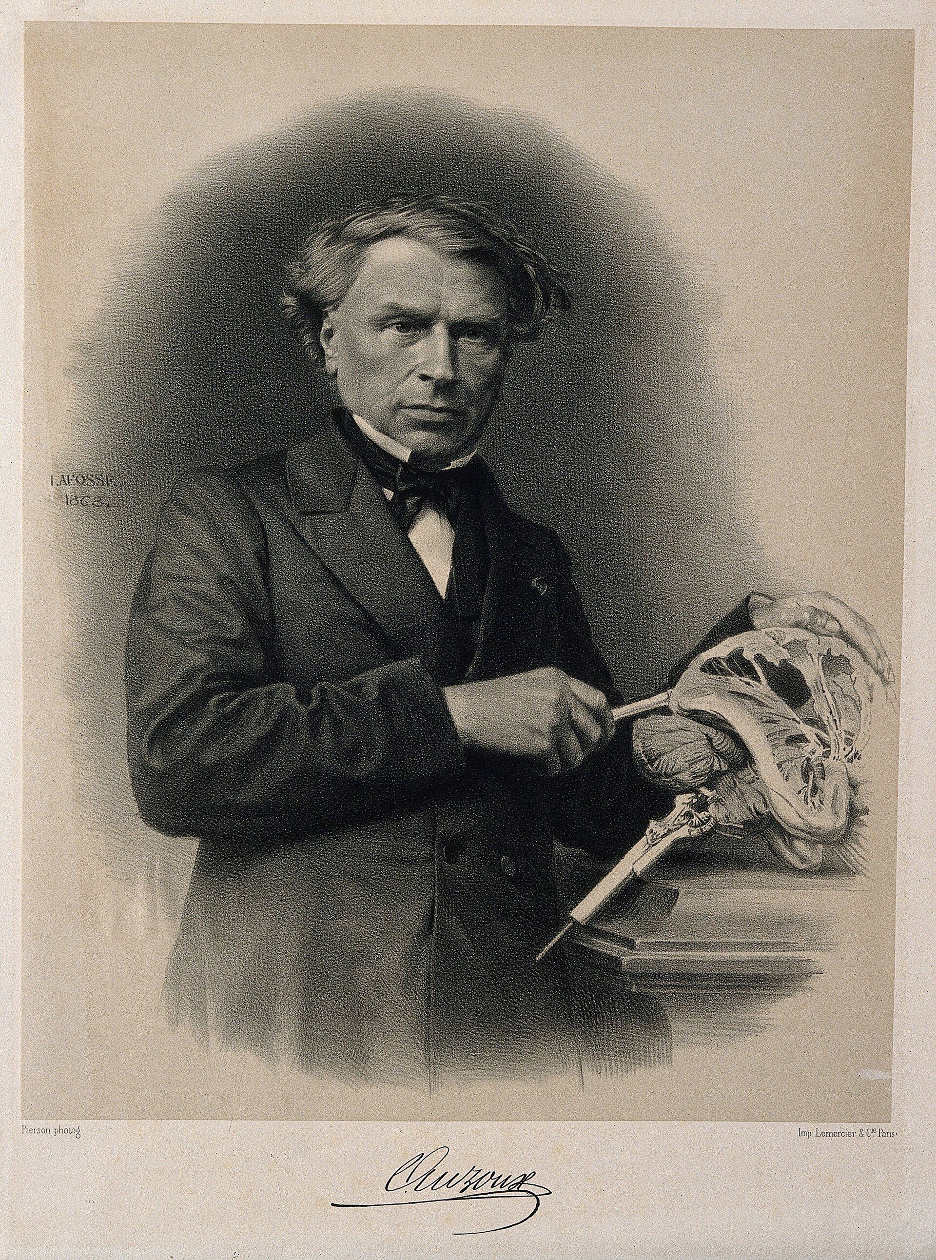 Louis Auzoux seated at a table with his hand beside a model of the human head.
