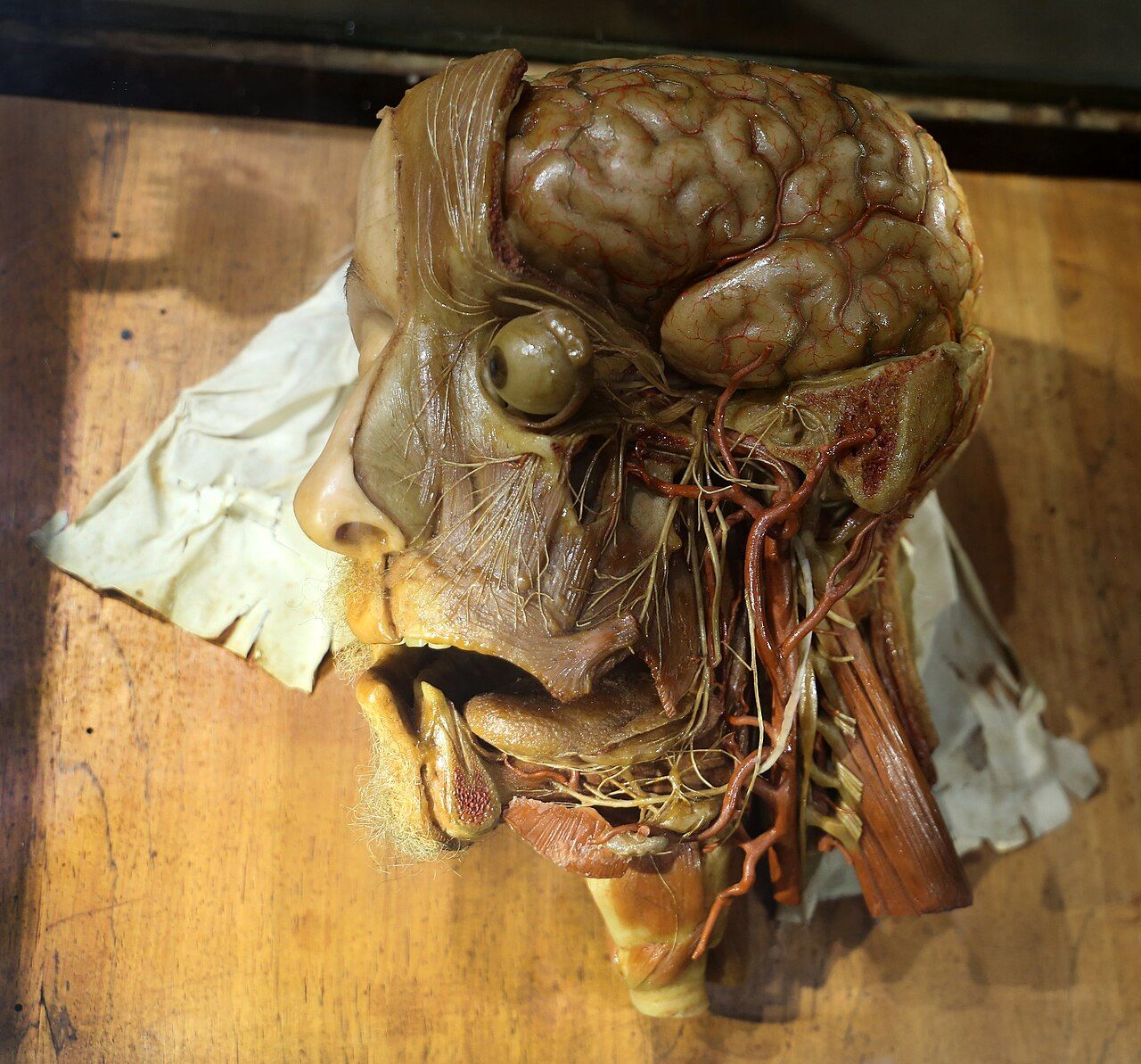 A wax head and neck with the skull opened to show the brain, vessels and branches of nerves running through the face.