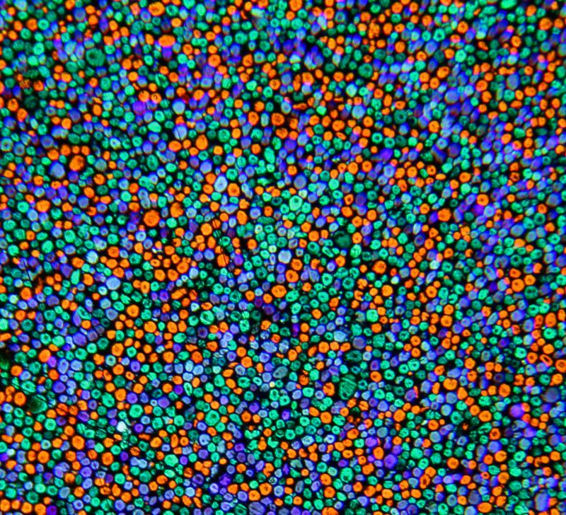 A magnified random mosaic of orange-red, green and violet-blue grains, separated by dark spaces.