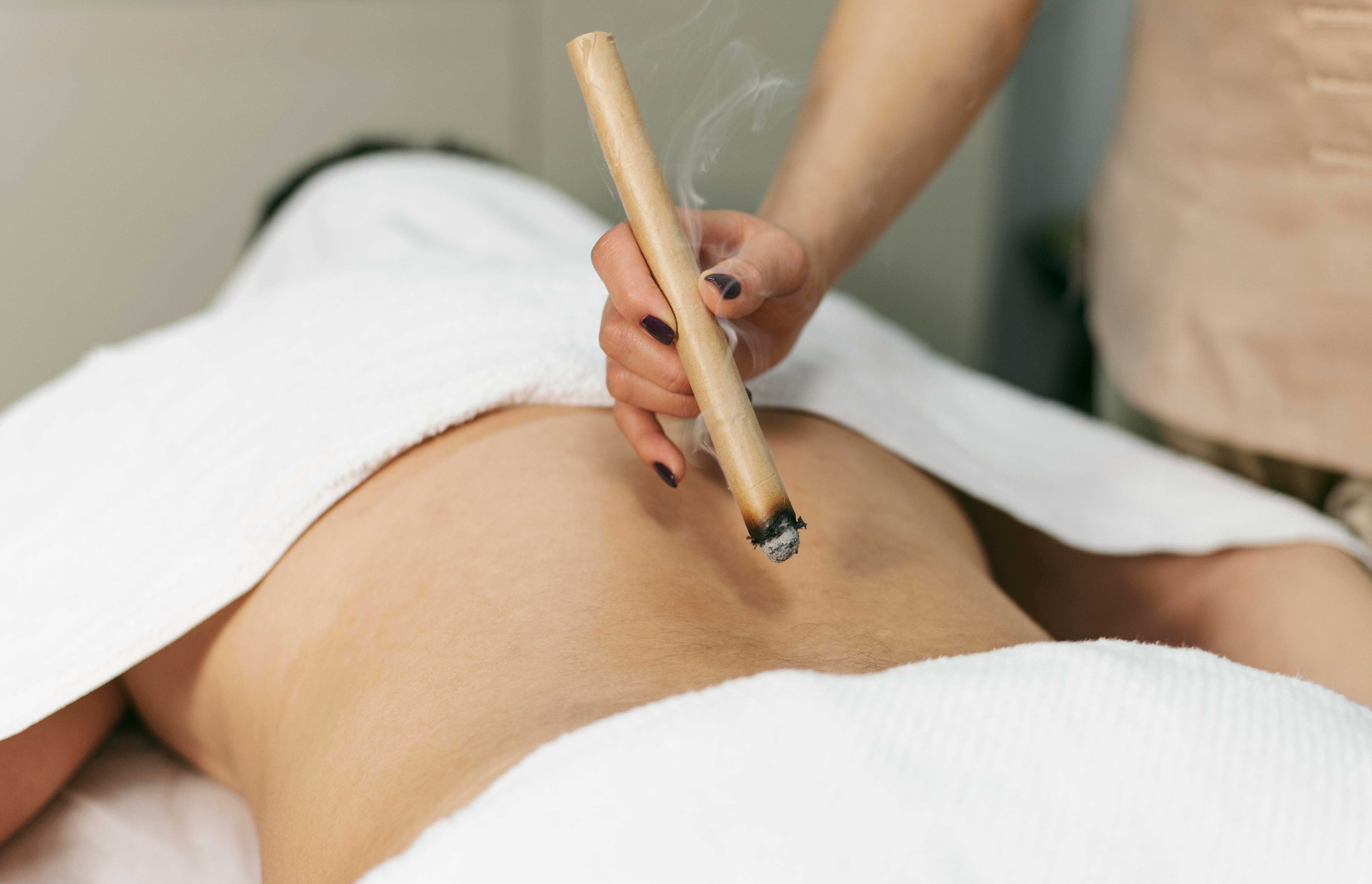 Praticien appliquant un bâtonnet de moxa sur le dos d’un patient pour réchauffer un point d’acupuncture, technique de la moxibustion issue de la médecine traditionnelle chinoise.